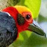Bristlehead (Pityriasis gymnocephala)